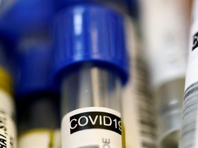 Tube tests are pictured pictured as media visit the Microbiology Laboratory of the University Hospital (CHUV) during the COVID-19 outbreak in Lausanne, Switzerland, March 23, 2020.