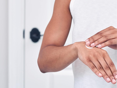 How to heal dry skin woman applying lotion to dry hands