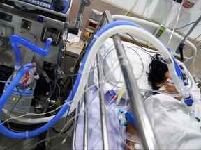 A patient suffering from COVID-19 connected to a ventilator tube in the intensive care unit is seen at the King Chulalongkorn Memorial Hospital in Bangkok, Thailand, May 11, 2021.
