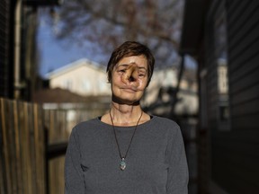 Sharon Durham pictured in Edmonton on Monday Nov. 8, 2021. Durham had her rare cancer surgery cancelled in Saskatchewan and then rescheduled in Edmonton when Alberta was at the peak of its fourth wave.