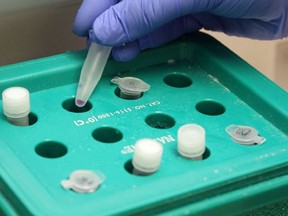 Medical laboratory technologist Danielle Lalonde handles samples for COVID-19 testing at Belleville General Hospital in Belleville, Ont., on Aug. 25, 2020