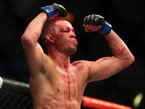 Nate Diaz reacts against Leon Edwards during UFC 263 at Gila River Arena.