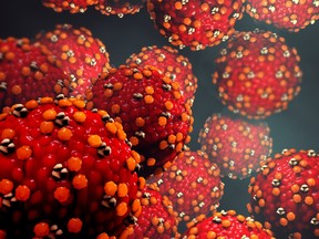 Peel Public Health has issued a warning after a child contracted measles.