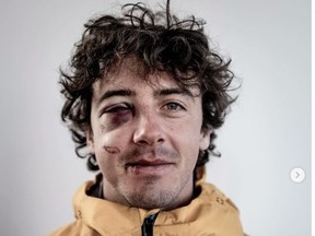 Mark McMorris is feeling much better after his accident.