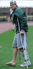 EDMONTON, ALTA: /September/ 5, 2012 --Burke Dales is sporting crutches at the Edmonton Eskimos practice at Commonwealth stadium in Edmonton , September 5, 2012. (Bruce Edwards/Edmonton Journal)