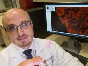 Dr. Vincent Biron, a head and neck oncologic surgeon at the University of Alberta poses for a photo with a new tissue scanner which can obtain molecular information from patient tumours that can be used to tailor treatment plans at University of Alberta in Edmonton on January 27, 2015.