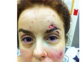 A provincial court judge said Thursday Dr. Simona Tibu’s injuries were caused when she fell while handcuffed and resisting arrest.