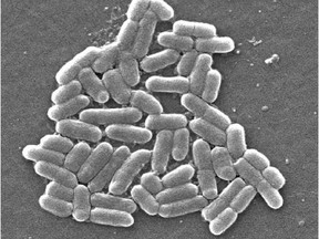 E. coli O157:H7  CDC Public Health Image Librabry