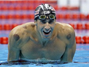 In this Aug. 9, 2016, photo "cupping" marks are seen on the shoulders of United States' Michael Phelps as he celebrates winning the gold medal in the men's 200-metre butterfly during the swimming competitions at the 2016 Summer Olympics in Rio de Janeiro, Brazil.