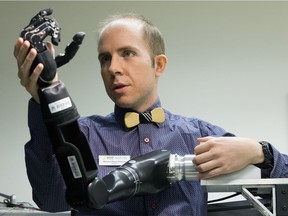 Roboticist Michael (Rory) Dawson poses for a photo with a Modular Prosthetic Limb that can feel and move like a human hand, in a Sensory Motor Adaptive Rehabilitation Technology (SMART) Network lab, at the Katz Group Centre for Pharmacy and Health Research, in Edmonton Thursday, Jan. 12, 2017. SMART Network is a University of Alberta network of scientists working on cutting edge research in new health innovations for amputees and others with neural injury or disease.