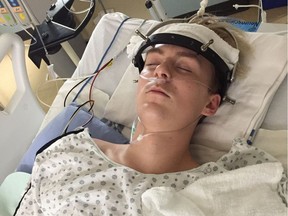 Landon Smith, 18, is recovering after spinal surgery on Jan. 10, 2017, following an injury he sustained while at a trampoline facility in Sherwood Park.