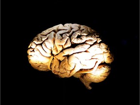 MRIs show brains of teens struggling with mental illness are wired differently, according to new University of Alberta research.