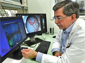 University of Alberta researcher Dr. Jack Jhamandas looks at amyloid deposits in mice in his lab in Edmonton, Thursday, Feb. 16, 2017.