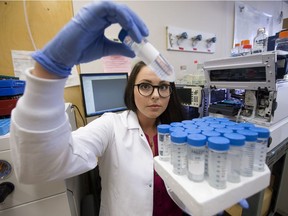 Lindsay Blackstock, a third-year University of Alberta PhD student in analytical and environmental toxicology, looks at swimming pool water samples in the lab in Edmonton on Wednesday, March 1, 2017.