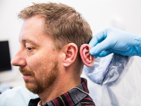 A prosthetic ear is compared to the real ear of patient Michael Brown in this file photo from Edmonton's Institute for Reconstructive Sciences in Medicine.