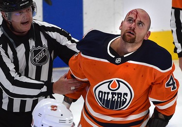 Edmonton Oilers forward Zack Kassian is bloodied after a fight with Calgary Flames counterpart Tanner Glass during NHL action on Oct. 4, 2017, at Rogers Place in Edmonton.