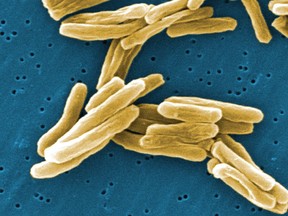The mycobacterium tuberculosis (TB) bacteria is shown in a 2006 high magnification scanning electron micrograph image.