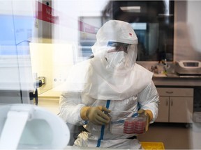 In this file photo a scientist manipulates Koch's bacillus, responsible of the tuberculosis, at the laboratory of the centre of research on infectious diseases of the University Hospital Institute (IHU) Mediterranean Infection, in Marseille, on March 29, 2018. - August 23, 2018. It's the world's number one killer among infectious diseases, but tuberculosis has been eclipsed by HIV/AIDS as a focus of global attention and donor funding.  When world leaders gather at the United Nations next month, they will be asked to change that by committing to end the tuberculosis pandemic by 2030 and come up with $13 billion annually to achieve that goal.