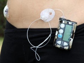 A Continuous Glucose Monitor, left, (CGM) and the insulin actual pump is the item on the right. Chloe Steepe, has Type 1 Diabetes, and this is her pump. Ottawa, On., on May 30, 2010. Jana Chytilova / Postmedia