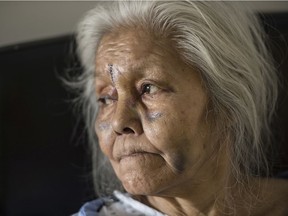 Dora Campbell at the University of Alberta Hospital on Tuesday, Feb. 18, 2020. The 72-year-old woman was attacked in her home and says the man who assaulted her and set her house on fire returned to save her from the flames.
