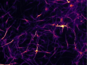 Neurons differentiated with artificial cells shown through a fluorescence microscope at 20X magnification.