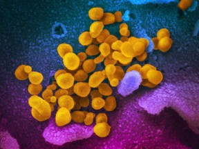 Electron microscope image made available by the U.S. National Institutes of Health in Feb. 2020 shows the Novel Coronavirus SARS-CoV-2, yellow, emerging from the surface of cells, blue/pink