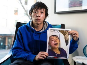 Pacey Dumas was hospitalized with a severe head injury on Dec. 9, 2020, which required doctors to remove a section of his skull. In a lawsuit, Dumas and his family say the injury was caused by an Edmonton Police Service officer. He was 19 at the time of the incident. Supplied image from 2021.