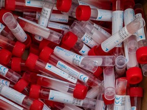 Vials of testing fluid are seen at a drive-through COVID-19 testing site in Louisville, Ky. The temporary site can provide 3,000 tests per day in response to the sharp increase in Omicron cases in the U.S.