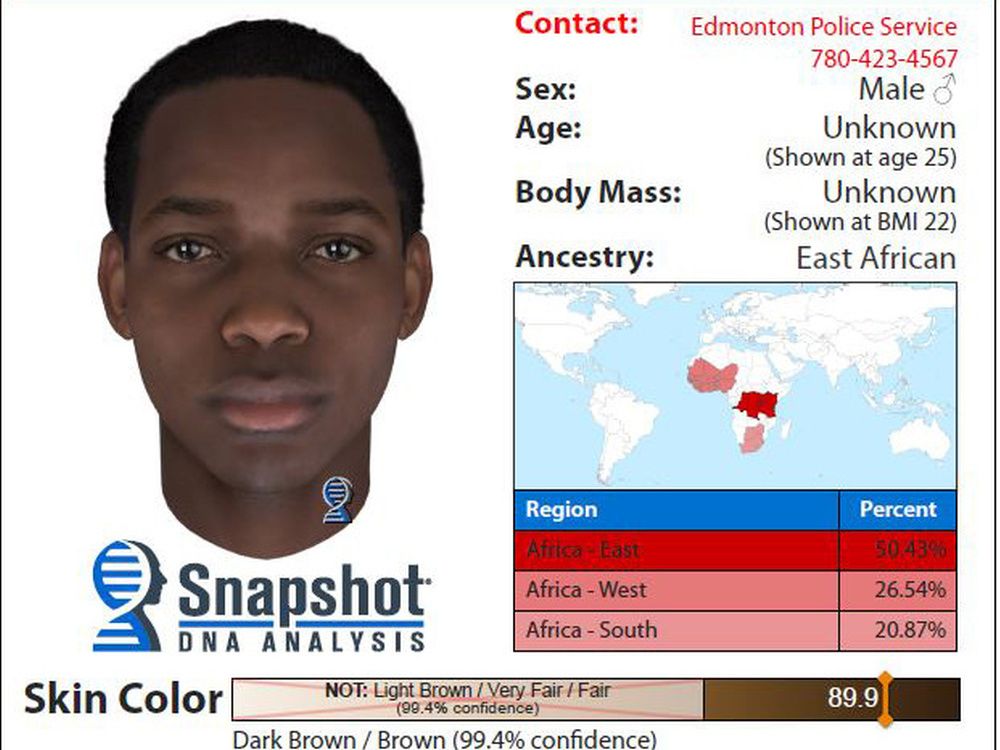 Edmonton Police Turn To Dna Technology In Unsolved 2019 Sexual Assault Edmonton Journal