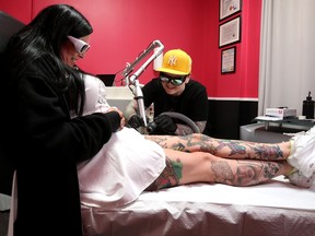 Legacy Tattoo Removal