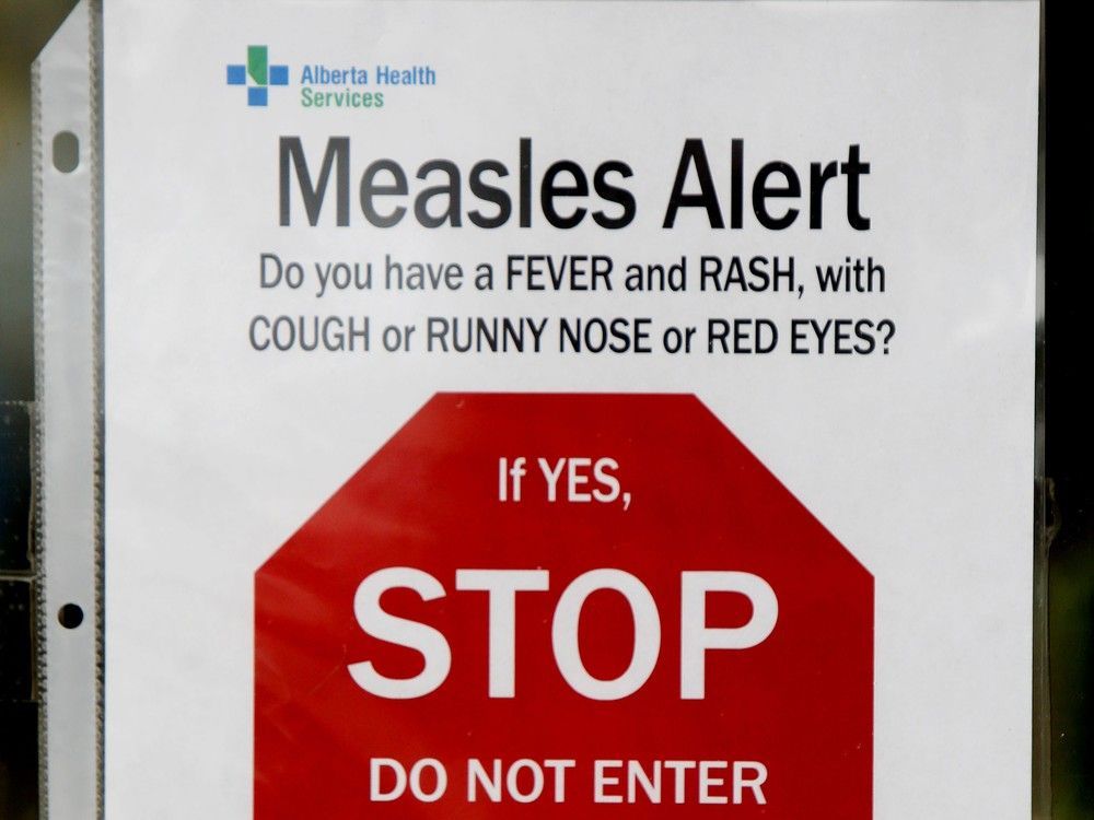 Alberta measles cases hover at 1,000 as AHS issues Edmonton's latest alert