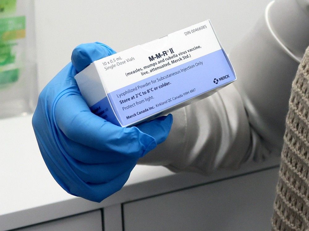 Alberta has recorded its highest number of measles cases in nearly four decades, with 868 confirmed infections as of Thursday.
