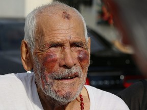 In this July 11, 2018, file photo, Rodolfo Rodriguez, 92, thanks well-wishers for their help, as he talks to the media gathered outside his home in Los Angeles.