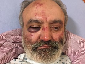 Taxi driver Balwinder Mander was attacked by a passenger outside a southeast community police station in the early morning hours of Monday, Feb. 18, 2019. Police are investigating.