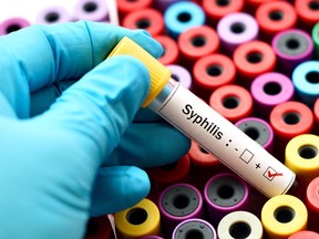 Alberta experienced a dramatic rise in syphilis rates in 2018, according to the chief medical officer of health