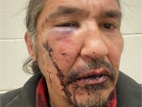 Chief Allan Adam of the Athabasca Chipewyan First Nation says he was beaten up and his wife man-handled by RCMP officers after they left a casino in Fort McMurray.