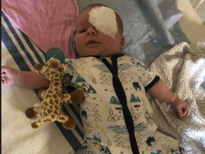 Mason Cook, who was struck with bilateral retinoblastoma, sleeps after having surgery recently to remove his eye at Toronto's Hospital for Sick Children. Supplied