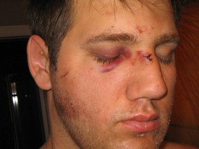 Jason Paul is suing the Edmonton police for a 2006 assault at an Old Strathcona bar. He alleges at least two police officers participated in the assault.Image supplied