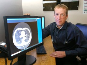 Alain Tremblay, a respirologist in Calgary who's helping lead a new AHS pilot for lung cancer screening in Calgary on Tuesday, December 13, 2022. Darren Makowichuk/Postmedia