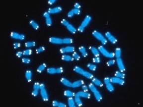 This undated image made available by the NIH's National Cancer Institute shows the 46 human chromosomes in blue, with telomeres appearing as white points on the ends.