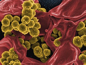 Methicillin-resistant staph surround human immune cell.