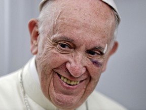 Pope Francis talks to journalists during a press conference he held on board the flight to Rome, at the end of a five-day visit to Colombia, Monday, Sept. 11, 2017. Francis' visit to Cartagena got off to a rocky start when he banged his head on his popemobile when it stopped short amid swarms of well-wishers. The pontiff, who only had a hip-high bar to hold onto, lost his balance and suffered a bruised, black left eye and a cut on his eyebrow.  (AP Photo/Andrew Medichini, pool)