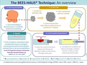 BEES-HAUS, an illustrative overview of the steps from tissue harvest to cell transplant for urethral stricture and a glimpse of the results