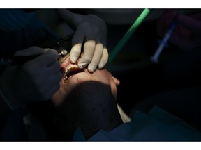 FILE- In this April 3, 2018, file photo, a dentist works on polishing and contouring the teeth of a patient at his dental office in Virginia Beach. Va. Roughly 1 in 4 Americans don't have dental coverage, according to industry figures. Employers are by far the biggest provider of dental coverage in the U.S., accounting for nearly half of all enrollees, followed by the government's Medicaid plan for low-income people.