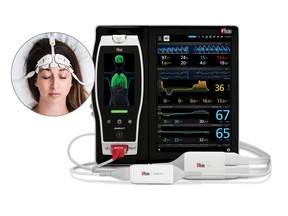 Masimo Root® with O3® Regional Oximetry and Next Generation SedLine® Brain Function Monitoring