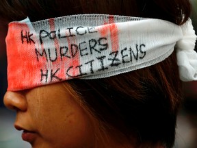 An anti-extradition bill protester covers her eye with a gauze during a mass demonstration after a woman was shot in the eye during a protest at Hong Kong International Airport.