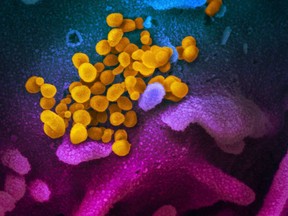 The virus (yellow) that causes COVID-19 isolated from a patient in the U.S.