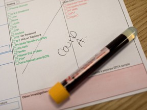 A blood sample sits on a table at an antibody testing program in Britain.