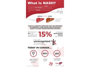 CanNASH Infographic -- What is NASH?