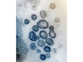 This undated electron microscope image made available by the U.S. National Institutes of Health in February 2020 shows the Novel Coronavirus SARS-CoV-2. Also known as 2019-nCoV, the virus causes COVID-19. The sample was isolated from a patient in the U.S. Dozens of research groups around the world are racing to create a vaccine as COVID-19 cases continue to grow. THE CANADIAN PRESS/AP-NIAID-RML via AP
